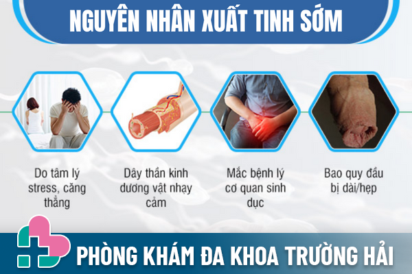 Xuat-tinh-som-o-nam-gioi-nguyen-nhan