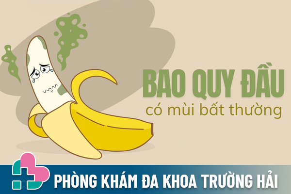 Bao quy đầu có mùi bất thường là bị gì?