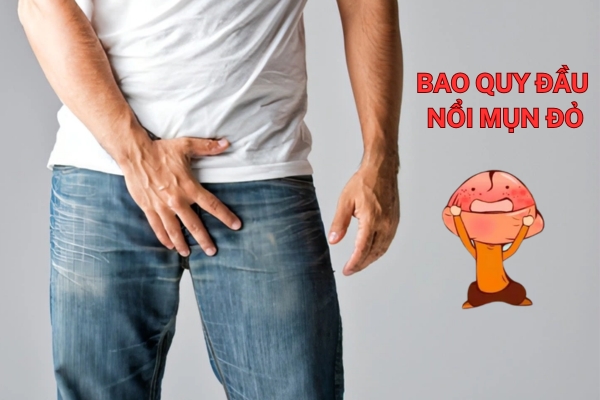 Nguyên nhân bao quy đầu nổi mẩn đỏ và cách điều trị