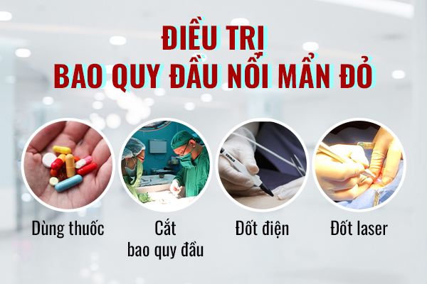 Dieu-tri-bao-quy-dau-noi-man-do