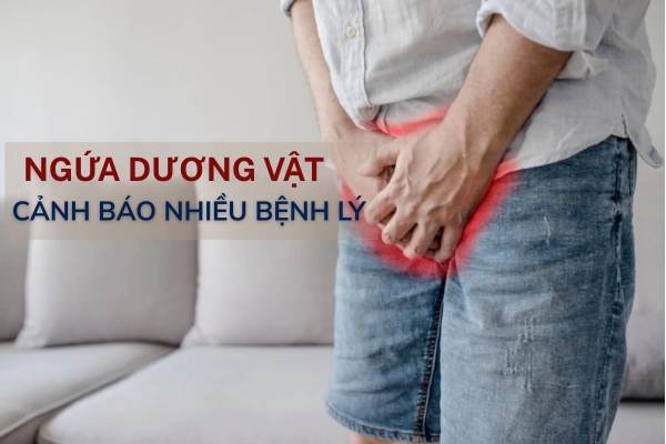 Ngua-duong-vat-do-dau (1)