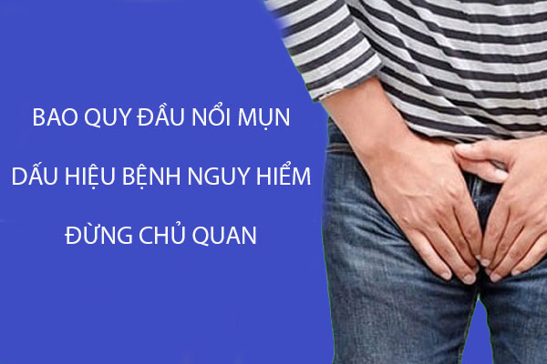 Bao quy đầu nổi mụn dấu hiệu bệnh nguy hiểm đừng chủ quan