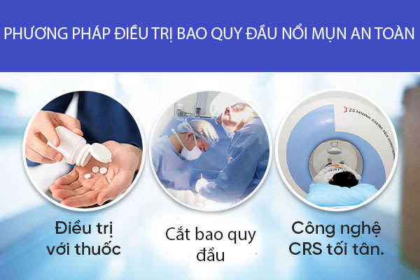 Dieu-tri-bao-quy-dau-noi-mun