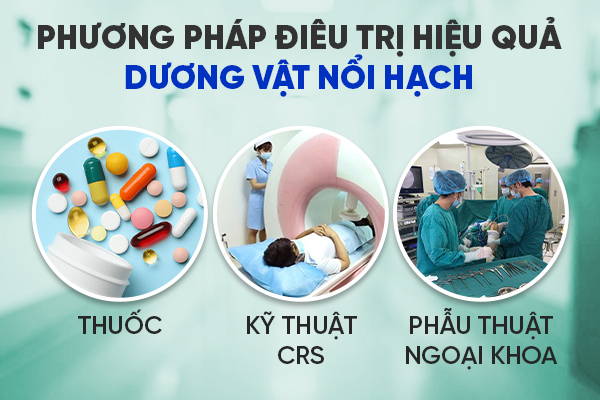 Dieu-tri-duong-vat-noi-hach
