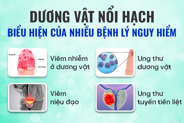 Dương vật nổi hạch – Bác sĩ cảnh báo bệnh lý nam khoa đe dọa tính mạng