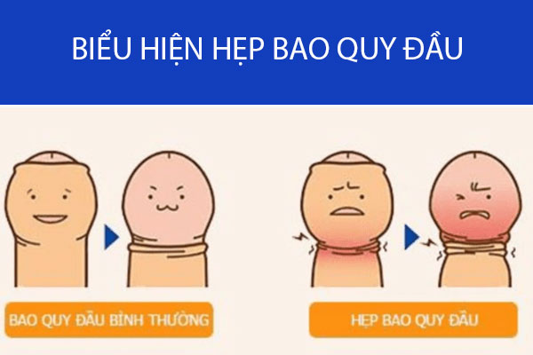 Hep-bao-quy-dau