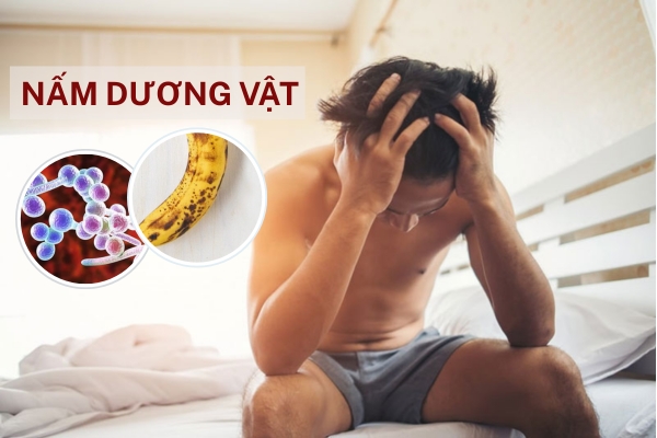 Nguyên nhân gây nấm dương vật nhiều nam giới bị mà không biết