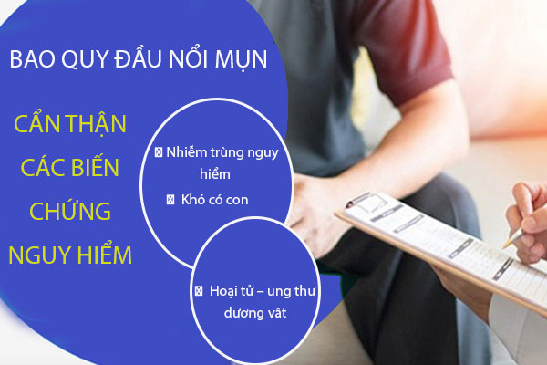 Nguy-hiem-bao-quy-dau-noi-mun