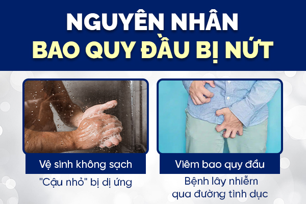 Bao quy đầu bị nứt hiện tượng đơn giản nhưng tiềm ẩn bệnh lý