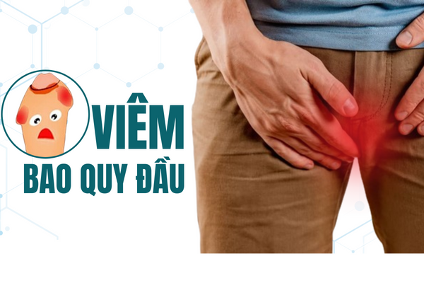 Cách chữa viêm bao quy đầu nhẹ nhàng, hiện đại